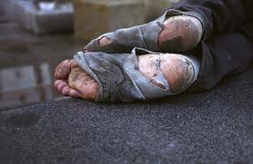 Photo of feet with socks with holes in them